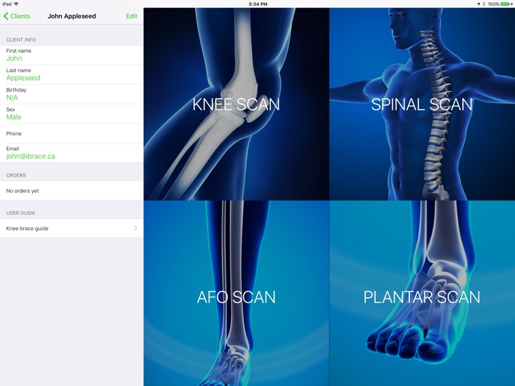iBrace Custom Orthotics