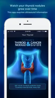 thyroid nodule & cancer guide iphone screenshot 1