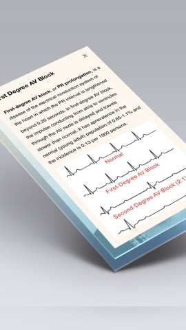 心電図ブック - ECG (EKG) Booksのおすすめ画像2