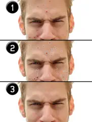 pimple eraser ipad resimleri 1