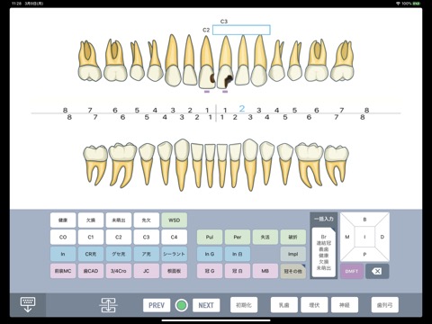 DentalXR InPutのおすすめ画像3