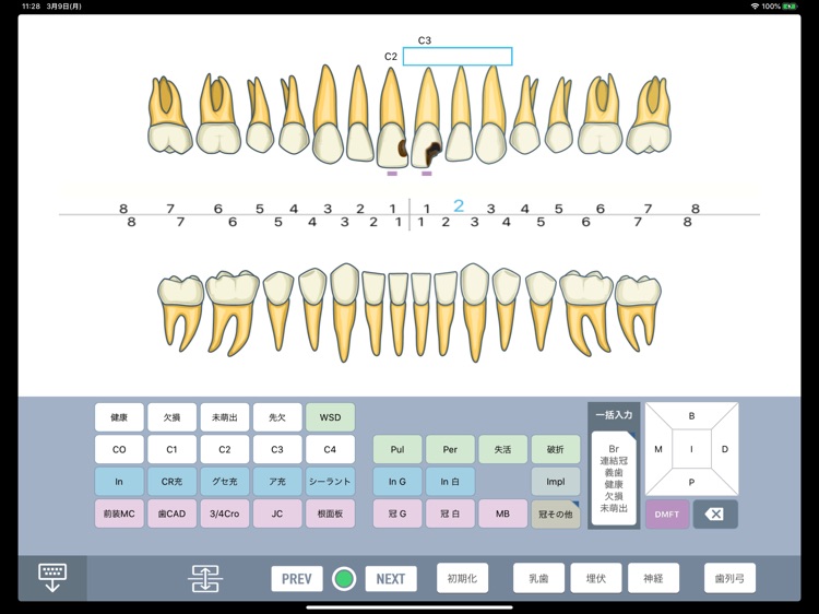 DentalXR InPut