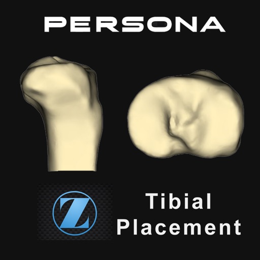 Persona® TKA Tibial Placement icon