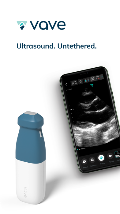 Vave Wireless Ultrasound Screenshot