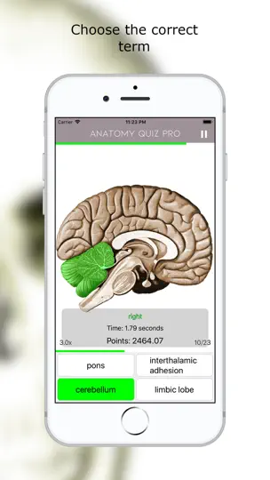 Screenshot von Anatomie Quiz Lite auf dem iPhone 5