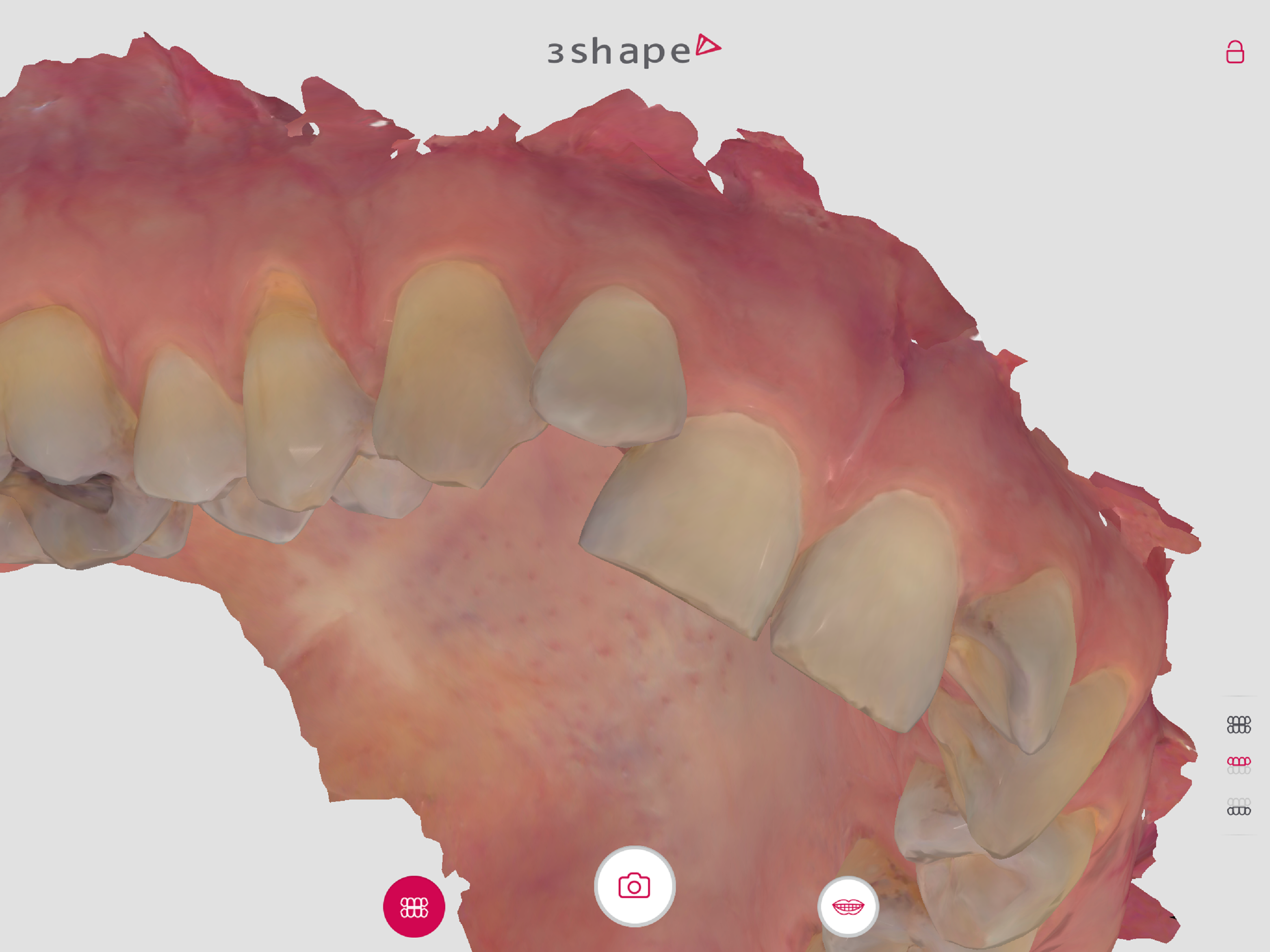 my3Shape for Patients screenshot 7