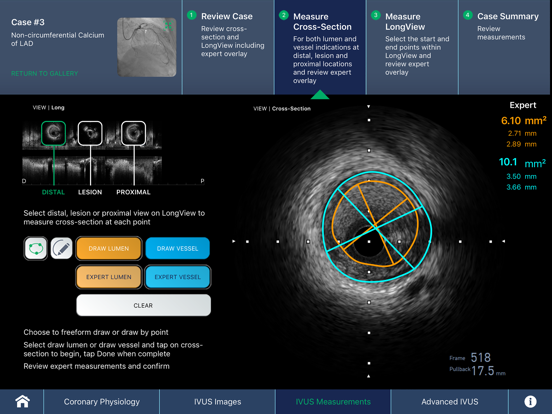 IVUS + Physiology Pro iPad screenshot 4 - Medical app