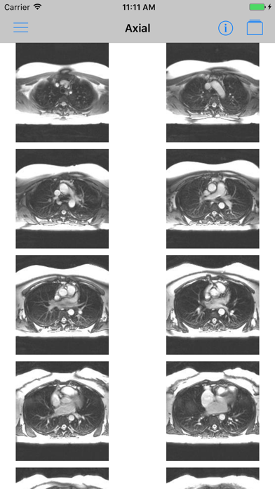 iAnatomy-Cardiac Screenshot 2