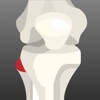 Peroneal Nerve Therapy App Icon