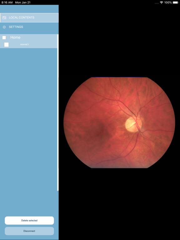 Screenshot #4 pour Optomed client