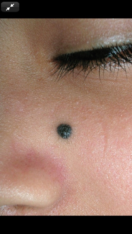 Atlas of Family Medicine, 3/E screenshot-6