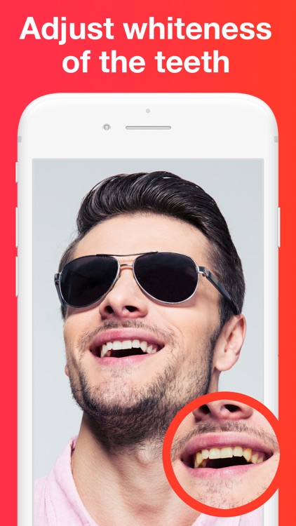 Teeth Whitener 2