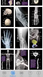 skeletal anatomy 3d problems & solutions and troubleshooting guide - 2