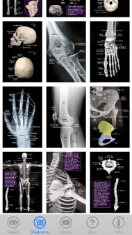 Skeletal Anatomy 3D iphone bilder 3