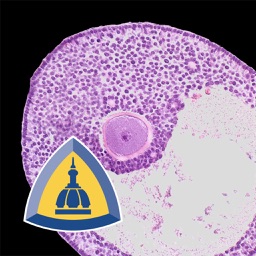 Ovarian Tumor Pathology