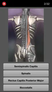anatomy quiz pro iphone capturas de pantalla 3