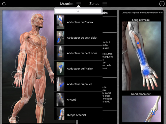 Screenshot #5 pour Muscle Trigger Points