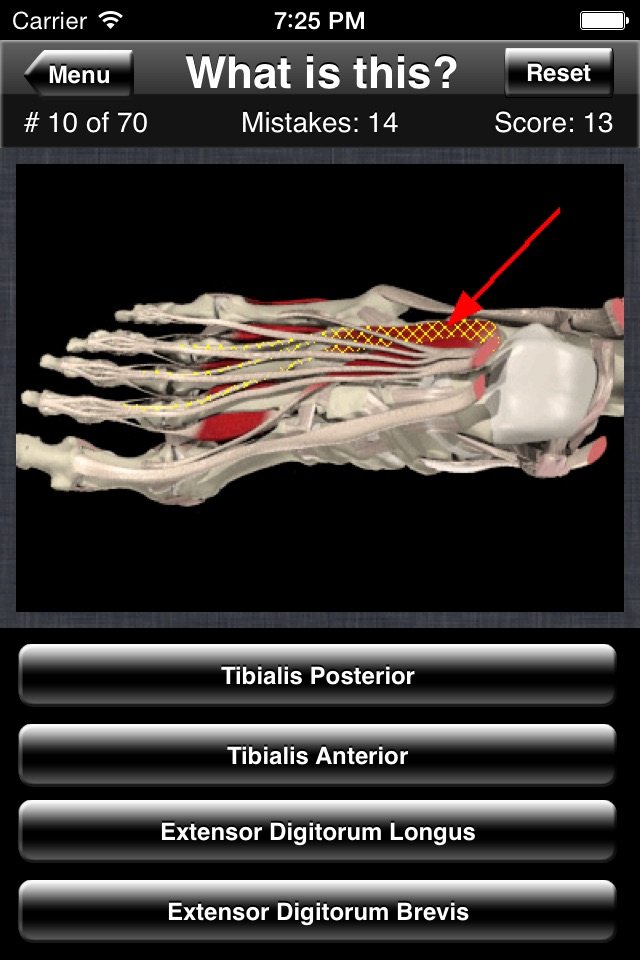 Anatomy Foot Quiz screenshot 4