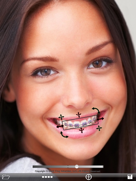 歯列矯正装置を付けよう (Brace Face)のおすすめ画像2