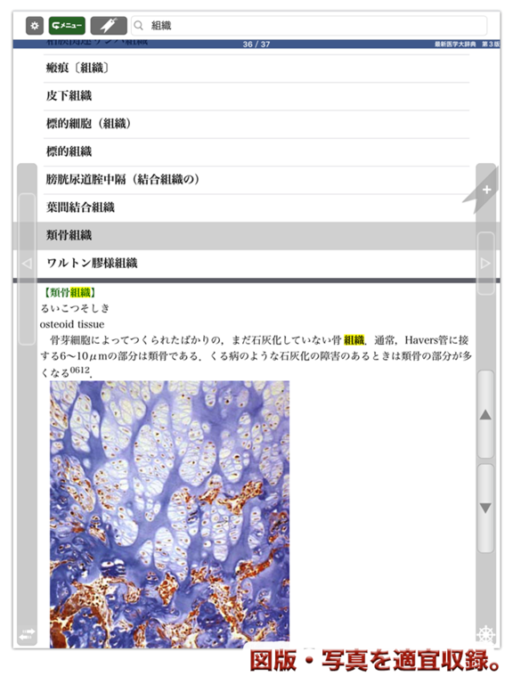 最新医学大辞典第3版【医歯薬出版】(ONESWING)のおすすめ画像3