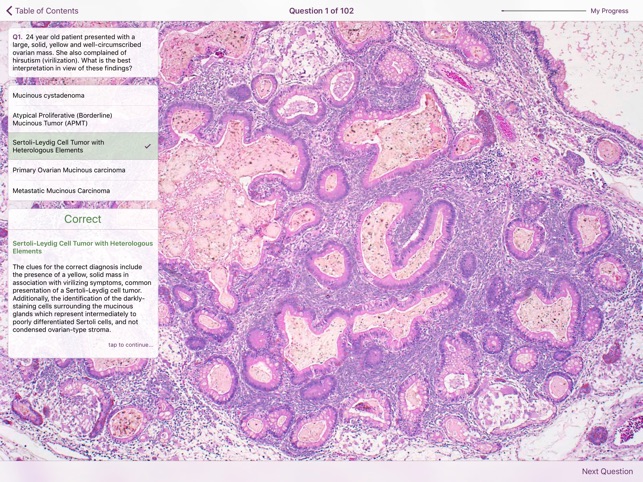 Ovarian Tumor Pathology(圖5)-速報App