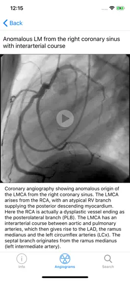 Game screenshot CARDIO3® Interventional Atlas apk