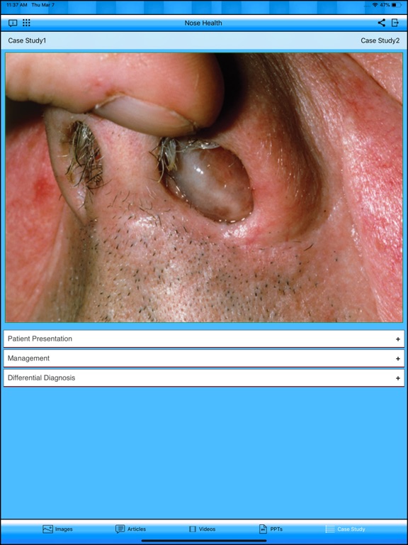 Nose Health iPad screenshot
