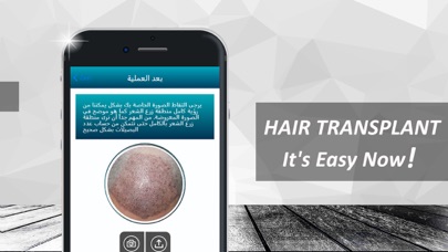 How to cancel & delete Hair Graft Helper from iphone & ipad 3