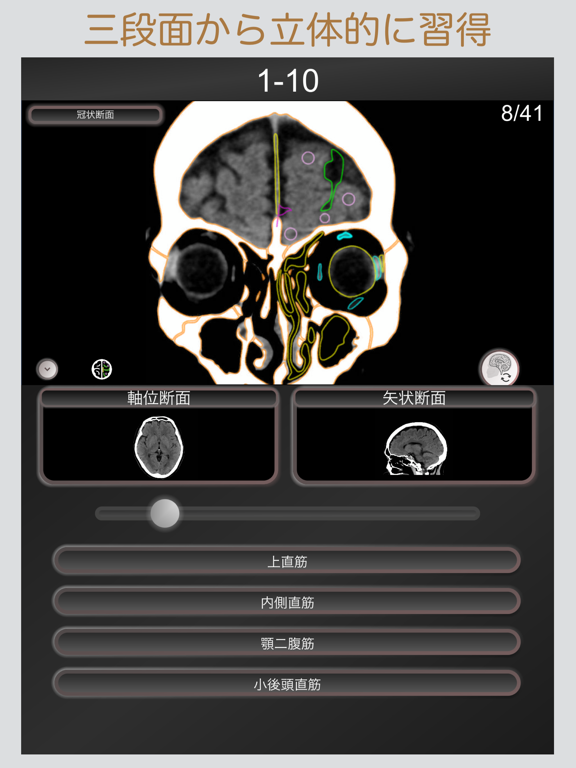 CT PassQuiz 頭部/脳 /CT断面図解剖MRIのおすすめ画像3
