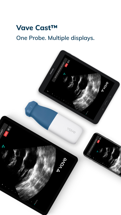 Vave Wireless Ultrasound Screenshot