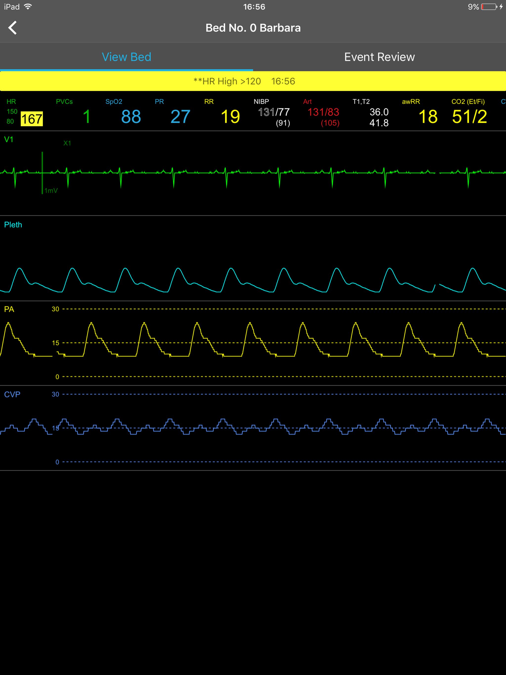 Mindray Mobile Viewer（FDA） screenshot 8