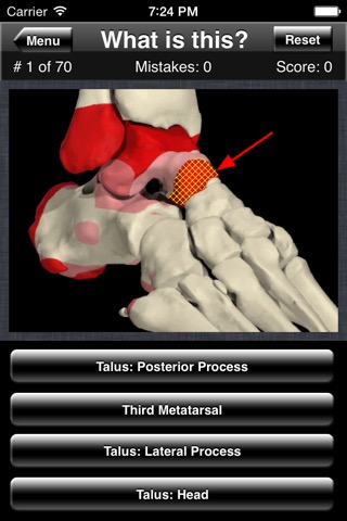 Anatomy Foot Quizのおすすめ画像3