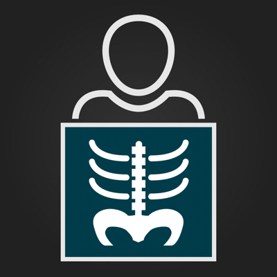 RX - Radiographic Positioning