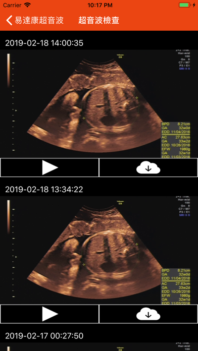 Screenshot #2 pour 易達康超音波平台