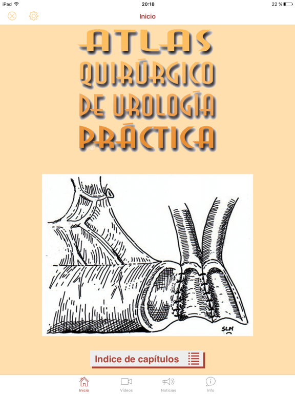 Screenshot #4 pour Atlas Quirúrgico de Urología