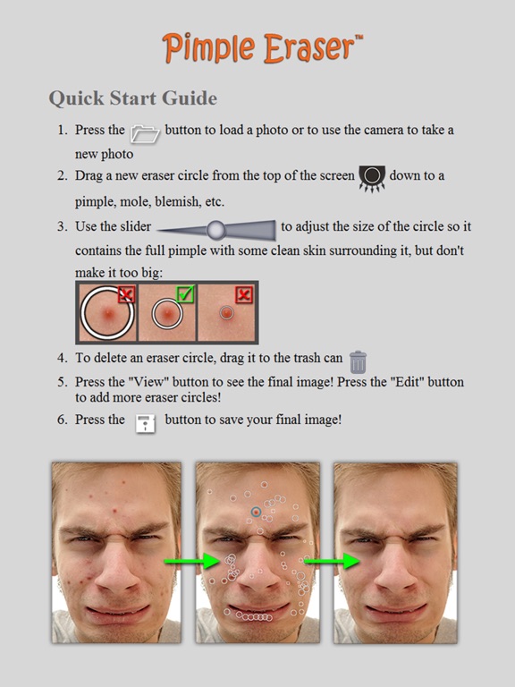 Pimple Eraser iPad screenshot 5 - Photo & Video app