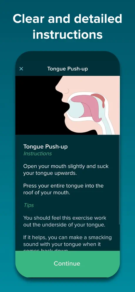 SnoreGym : Reduce Your Snoring