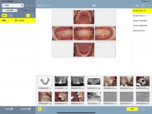 DentalXR TaKe screenshot 2