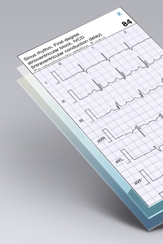 心電図ブック - ECG (EKG) Booksのおすすめ画像4