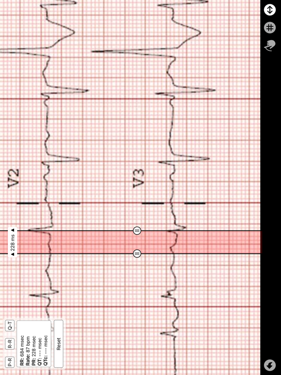 Screenshot #5 pour Compas ECG