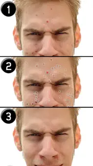 Pimple Eraser iphone bilder 0
