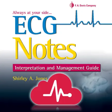 ECG Notes: Quick look-up ref. Cheats