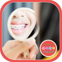Braces Teeth and Filter
