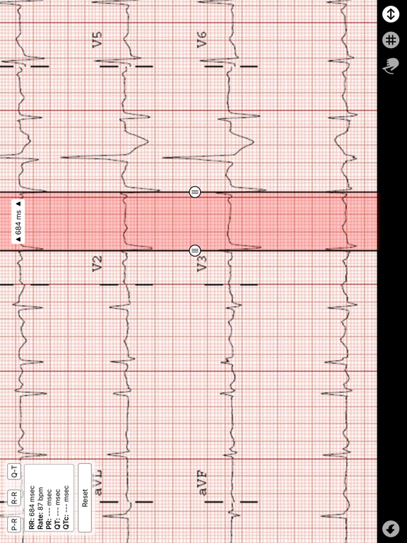 Screenshot #4 pour Compas ECG