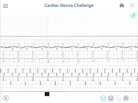 Screenshot #5 pour Cardiac Device Challenge