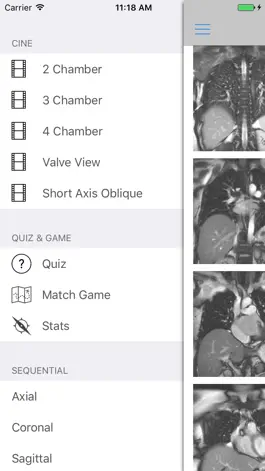 Game screenshot iAnatomy-Cardiac hack