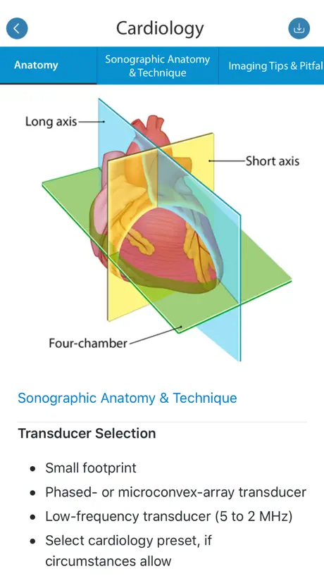 SonoSim