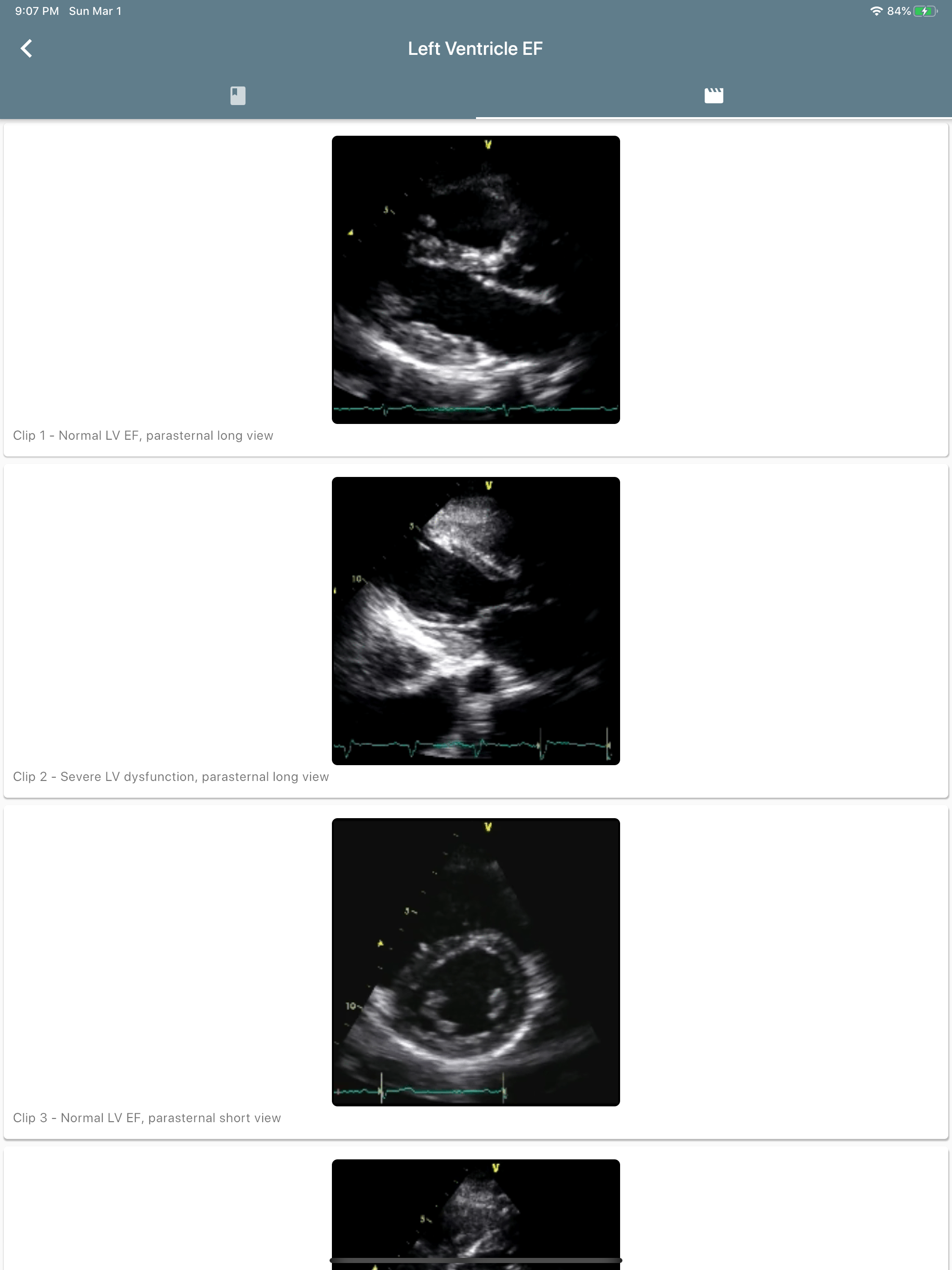 Resuscitation Ultrasound screenshot 12