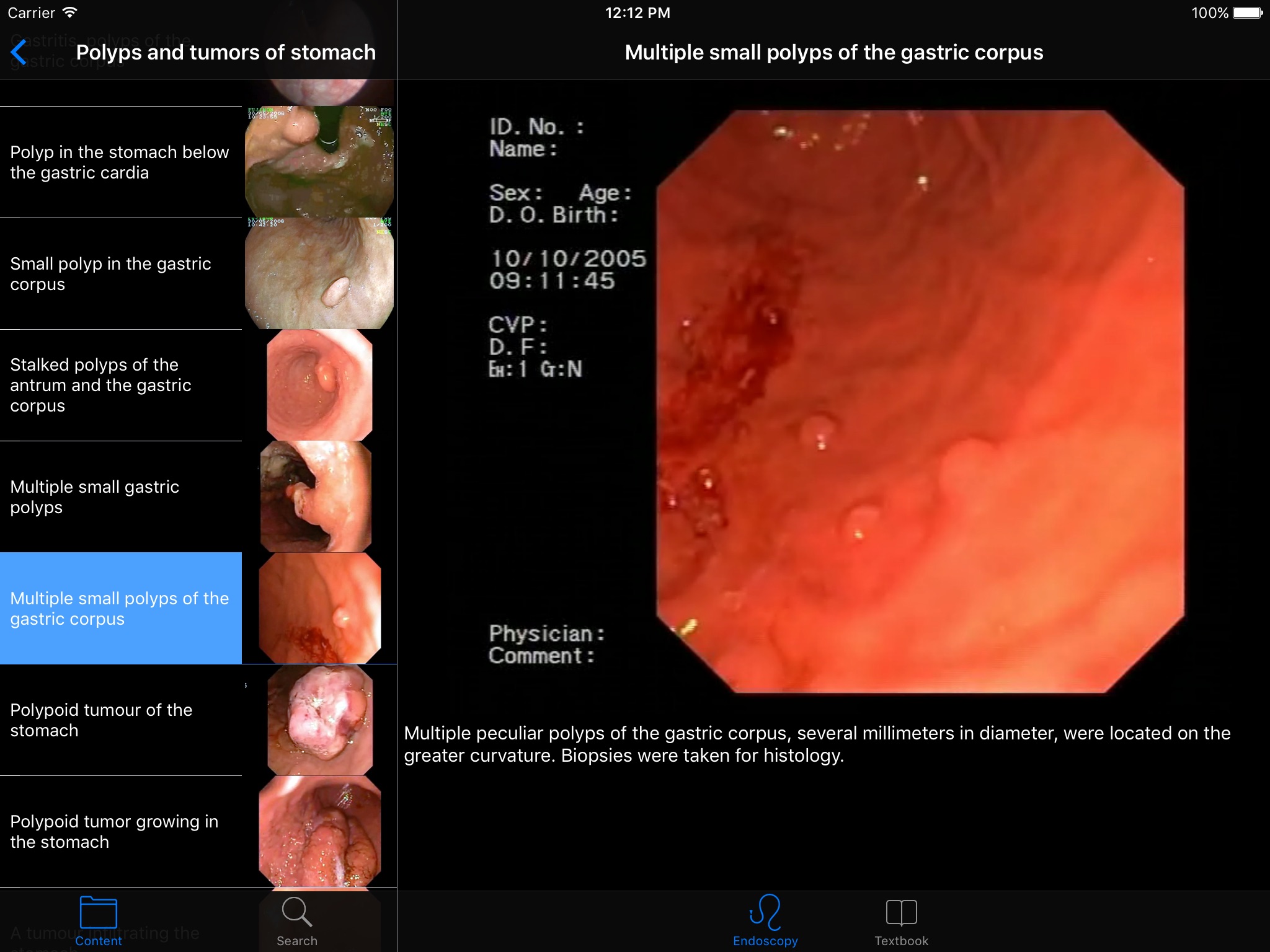 ENDO3®Atlas of GI Endoscopy HD screenshot 3