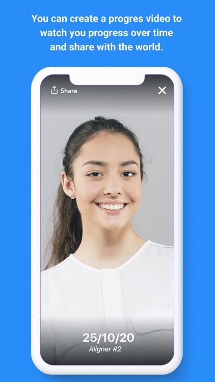 Aligner Smile Tracker screenshot-4